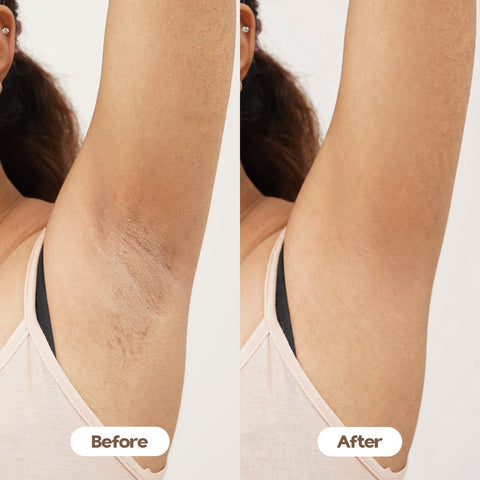 Time To Shine (Under Arm Serum)